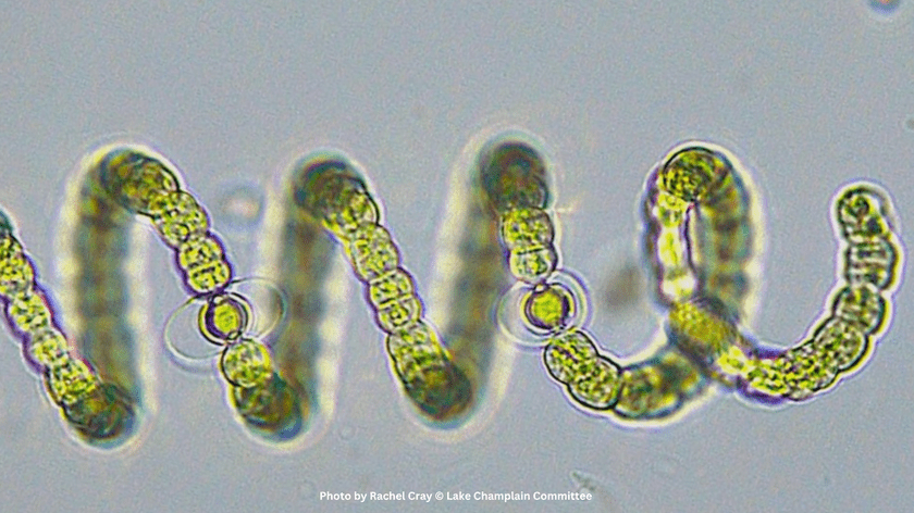 Filamentous cyanobacterium, Dolichospermum, forms spiraling chains of cells